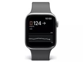 Apple Gli utenti di orologi possono già monitorare i loro livelli di zucchero nel sangue quando utilizzano i dispositivi Dexcom. (Fonte: Dexcom)