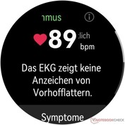 Risultato Funzione ECG