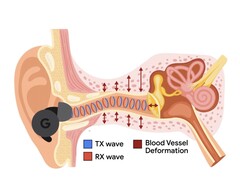 L&#039;APG utilizza toni ultrasonici modulati dalle variazioni di pressione nel canale uditivo (Fonte: Google Research)