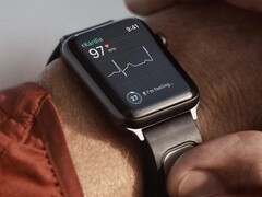 KardiaBand è una fascia per il monitoraggio dell&#039;ECG progettata per l&#039;orologio Apple. (Fonte: Kardia)